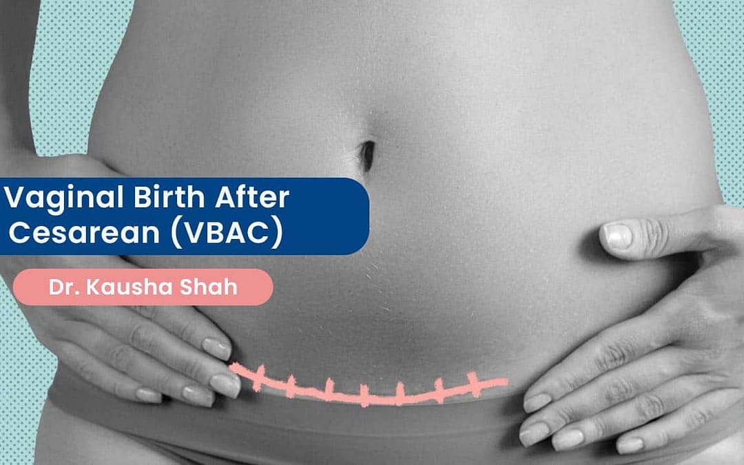 Vaginal Birth After Cesarean (VBAC): A Consideration for Safe Delivery